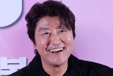 송강호 달라진 얼굴에 깜짝…"생기 되찾아" 이 성형술 효과 높이려면?