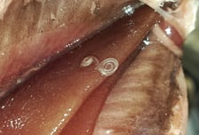 "왜 유독 한국인만"…췌장암보다 예후 더 나쁜 이 암, 환자 느는 이유