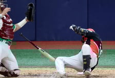 야구공이 '쾅'…머리에 이런 충격 후 "어지러워" 그냥 넘겼다간