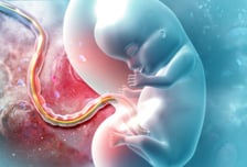 임신부 놀랄 연구결과…초미세먼지 심한 날 "태아 모세혈관 내부 손상"