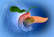 수술받더라도 치료 효과 알기 힘든 췌장암, AI로 예후 본다
