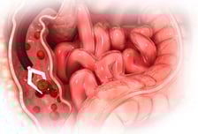 검붉은 혈변 봤다면 이미 '대장암'…내 몸이 보내는 6가지 SOS