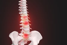 척추 수술했는데 계속되는 통증…"아프다고 다 치료하면 안돼" 의사 조언