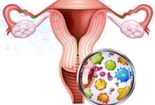"유해균 유독 많아"…당뇨병 여성 환자, 몸 '이곳' 관리도 필수