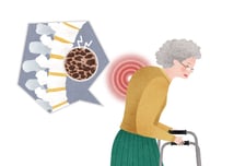 "나이 들면 다 그래"…할머니 점점 굽는 등, 그냥 놔뒀다간 [한 장으로 보는 건강]