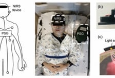 잘 때 일하는 '뇌 청소부' 측정 기술, 세계 최초 개발…치매 정복 앞당길까