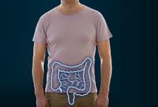 말기 대장암 환자, 수술 vs 항암…5년 생존율 '이것' 더 높았다