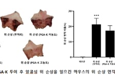 모아라이프플러스, 'PGA-K' 위산 조절 및 위 손상 억제 기능성 특허 출원