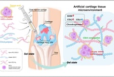 "코 세포로 연골 만든다"…무릎 손상, 퇴행성 관절염 새 치료법 나올까