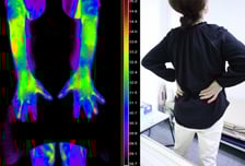 "이 더위에 손발 시려?"…허리까지 쑤신다면 단순 냉증 아닙니다