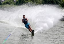 수상스키 타다 어깨서 '뚝'…방치했다가 기능 장애까지?