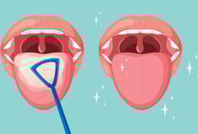 "입냄새 나나?" 칫솔로 혀 벅벅…어쩐지 효과 없던 이유[한 장으로 보는 건강]