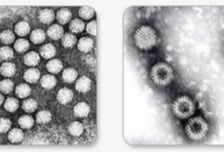 아이 손·발·입에 쫙 퍼진 물집…"이 약 먹이면 혼수상태 올 수도" 경고