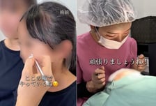 "예뻐지고 싶어?"…10세 초등생 성형수술 SNS 홍보한 일본 병원