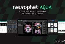 뉴로핏, '뉴로핏 아쿠아' 임상 유효성 입증…뇌 MRI 분석 시간 크게 줄여