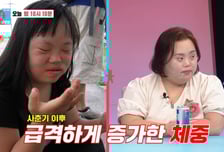 '다운증후군' 정은혜에 쏟아진 악플 공격…"병 때문인데" 엄마 분통