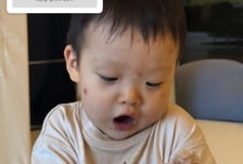 "염증+고름, 수족구인 줄" 손연재 아들 앓는 '스키터 증후군' 뭐길래