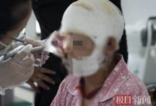 오른쪽 눈 뜯겨나갔지만 '죽은 척' 버텼다…곰 습격에도 임신부 기적 생존