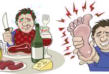 "양말도 못 신어" 극한 통증…맥주만 피하면 된다? '이 음료'도 위험