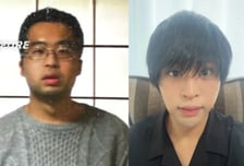 "못생겨서 연애 못해" 7500만원 들여 성형한 모태솔로…일본서 화제