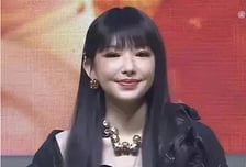 퉁퉁 부은 '우주소녀' 성소, '성형수술 부작용' 루머 알고보니