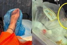 "도쿄에 쥐 바글바글, 발 물렸다" 이빨 자국, 피멍…관광객 '경악'