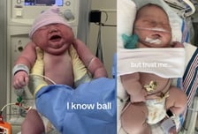 "몇 년 동안 뱃속에 있었던 거냐"…신생아 모습에 깜짝 놀란 이유