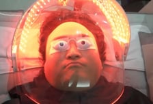 선크림 떡칠했는데도 "더 심해졌다"…구성환 앓는 이 질환, 뭐길래