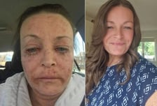 커리어우먼에서 알코올 중독자로…"갈수록 몸 망가졌다"