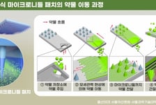 주사 찌를 일 없어질까…패치만 붙여도 약물 대용량 주입 가능해진다