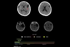 제이엘케이, AI 솔루션 'JLK-CTL' 혁신의료기기 통합심사 통과
