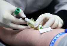 복지부, 검체 위탁검사관리료 폐지 추진…질평가 강화