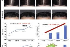 머리숱 풍성해지고 굵어졌다…보리밥나무, 1000만 탈모인 구세주 되나