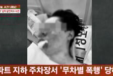 배트로 맞은 '100만 유튜버' 수탉, 안와골절 '처참'…납치 폭행 전말은?
