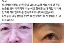 與추미애, 눈 충혈 사진 공개 "국정감사 22번 했지만 이런 경험 처음"