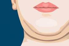 다이어트 성공해도 여전한 턱밑…'이중턱' 관리법[한 장으로 보는 건강]