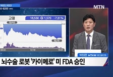 [주식민원처리반 2부] 뉴로핏 vs 고영, 매매 포인트는?