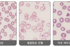 "요즘, 피부 하얘져 좋아" 70대 어르신…'이 질환' 의심 피검사 받으세요