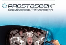 듀켐바이오 '프로스타시크', 전립선암 진단에 건보 적용