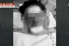 "얼굴 피범벅, 너무 분해"…송도서 납치당한 유튜버 수탉, 입 열었다