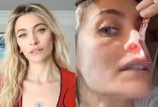 마이클 잭슨 딸 "마약, 내 인생 망쳐…코안에 구멍 뚫렸다" 경악