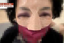 "80대 엄마 코뼈 부러졌는데 집유" 울분…묻지마 폭행남 부친은 "그럴 애 아냐"[영상]