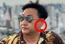 '실신' 김수용, 심정지 전조증상 포착?…귓불에 선명했던 '이 주름'