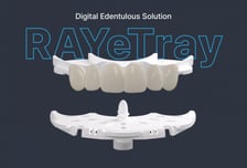 레이, '레이이트레이' 론칭…무치악 치료 디지털 혁신 가속화