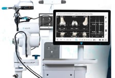 드퓨신테스, 무릎 인공관절 수술 로봇 '벨리스' 반치환술 국내 허가