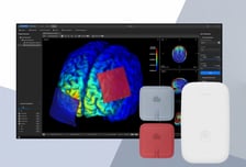 뉴로핏, 삼성서울병원에 '개인 맞춤형 tDCS 솔루션' 국내 첫 공급