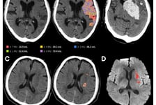 제이엘케이, 북미영상의학회 참가…美 파트너십 논의 본격화