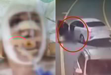 [영상] 블랙박스엔 비명만, 아버지뻘 대리기사 매달고 1.5km 악랄한 질주