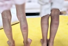 종아리 멍 가득, 자녀들 체벌 후 '찰칵'...SNS 인증샷 올린 엄마