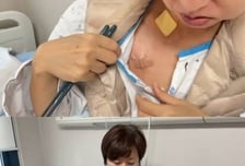 '유방암 투병' 박미선 "죽다 살아났다"...항암 과정 공개